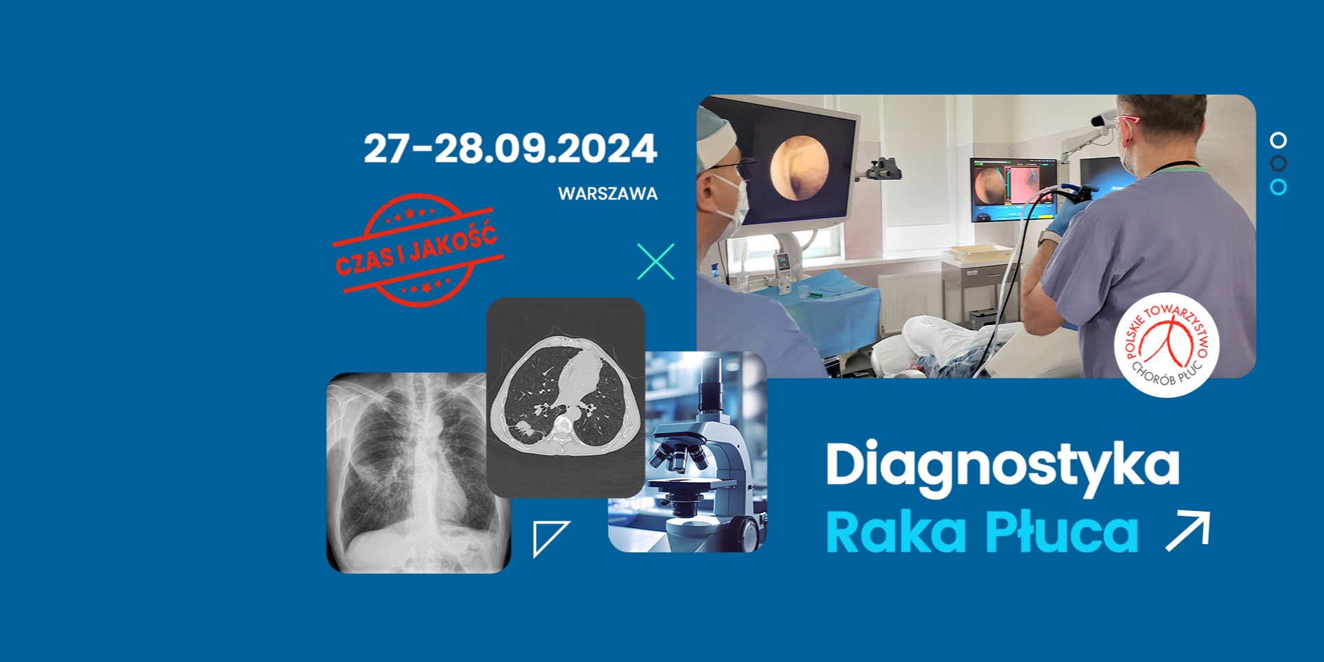 Diagnostyka raka płuca 2024