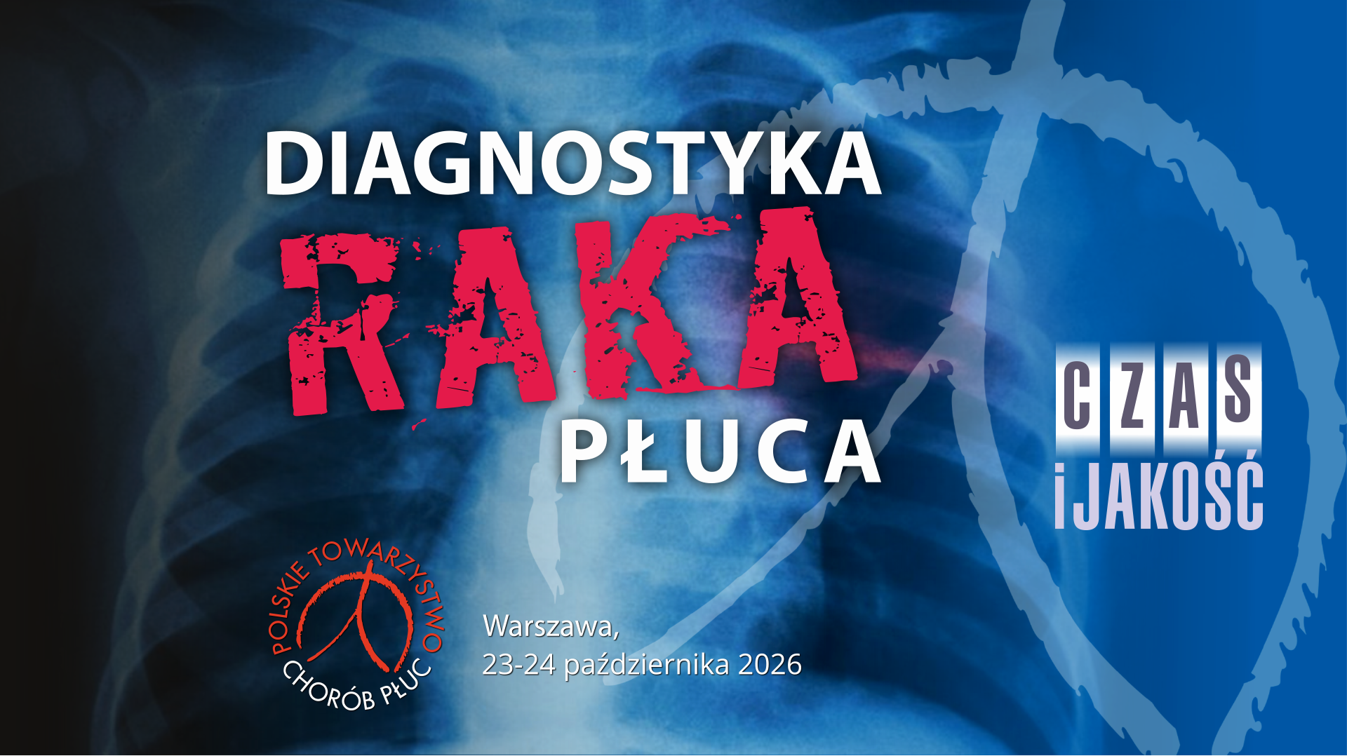 Diagnostyka raka płuca 2026